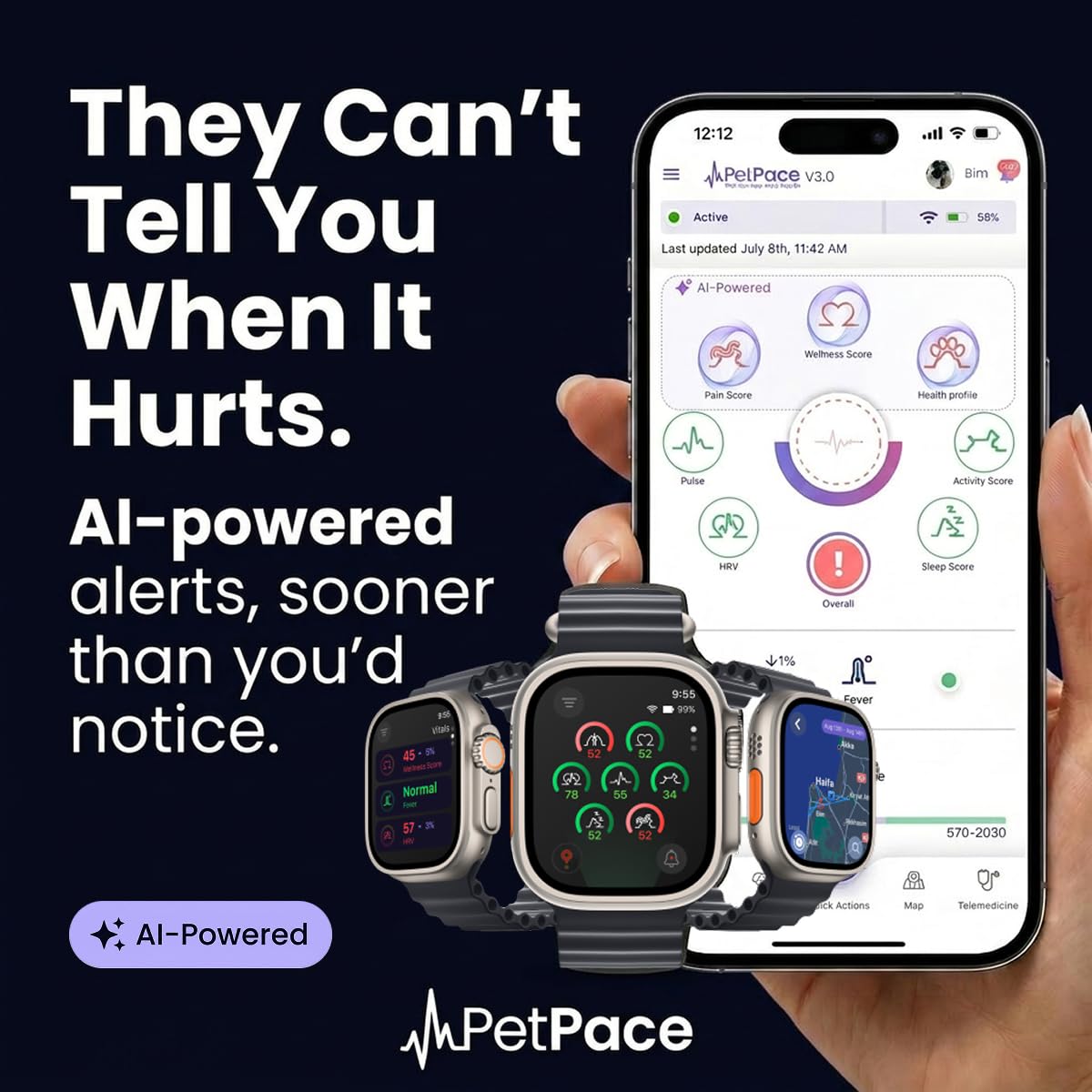 PetPace V3.0 Dog Health Monitor – AI Health Collar with 24/7 Vital Signs Tracks Pain GPS, Telehealth AskaVet & Share with Your Vet & Apple Watch Sync – Subscription Required